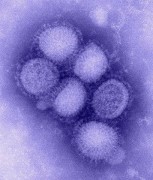 509px-H1N1_influenza_virus.jpg
